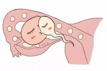 男性因素案例